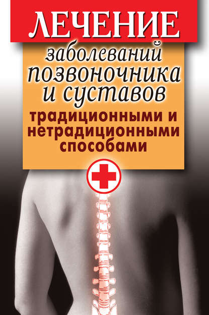 Лечение заболеваний позвоночника и суставов традиционными и нетрадиционными способами - Группа авторов