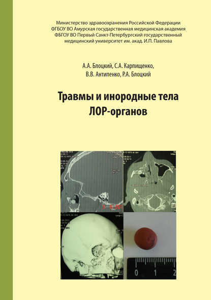 Травмы и инородные тела лор-органов - С. А. Карпищенко