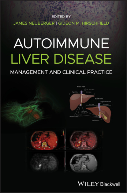 Autoimmune Liver Disease — Группа авторов