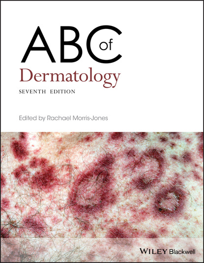 ABC of Dermatology - Группа авторов