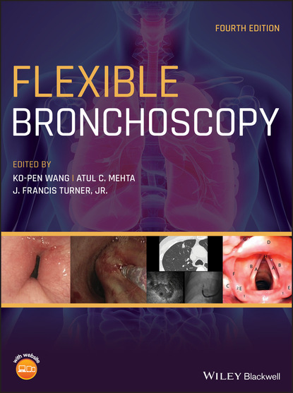 Flexible Bronchoscopy - Группа авторов