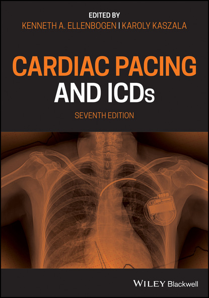 Cardiac Pacing and ICDs - Группа авторов