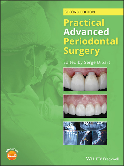 Practical Advanced Periodontal Surgery - Группа авторов