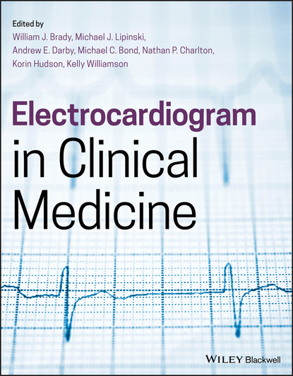 Electrocardiogram in Clinical Medicine - Группа авторов