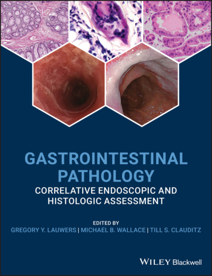 Gastrointestinal Pathology - Группа авторов