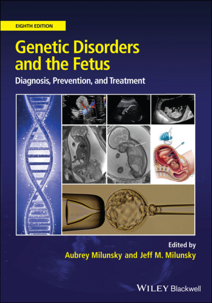 Genetic Disorders and the Fetus - Группа авторов