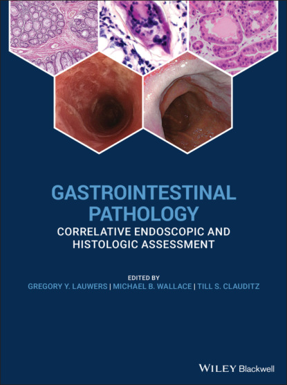 Gastrointestinal Pathology - Группа авторов