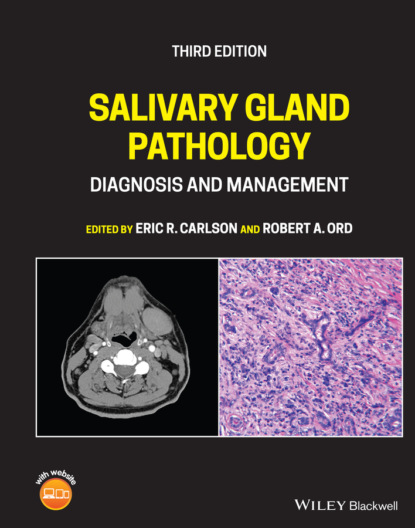 Salivary Gland Pathology — Группа авторов