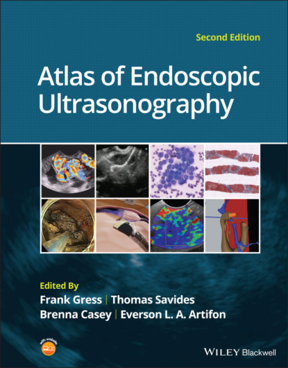 Atlas of Endoscopic Ultrasonography — Группа авторов