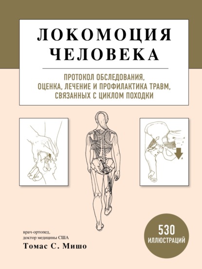 Локомоция человека. Протокол обследования, оценка, лечение и профилактика травм, связанных с циклом походки - Томас С. Мишо