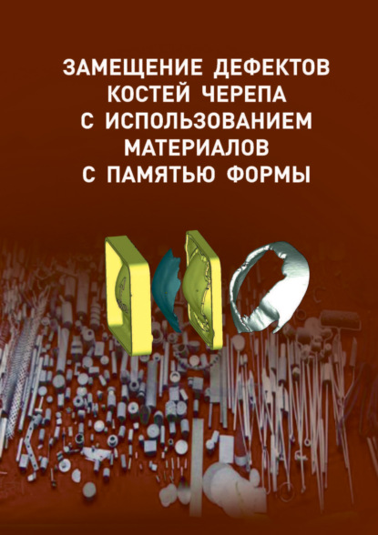 Замещение дефектов костей черепа с использованием материалов с памятью формы - Коллектив авторов