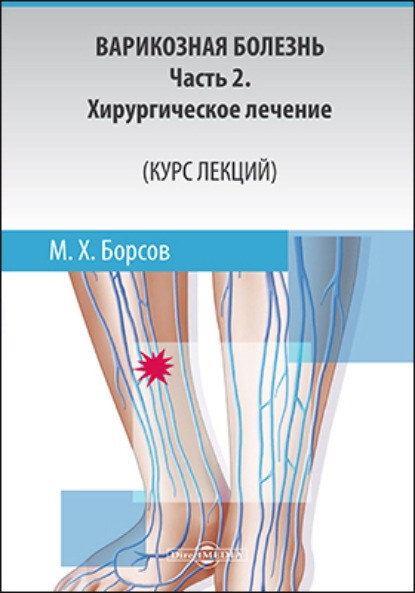 Варикозная болезнь: Часть 2 - Мухамед Хамзатович Борсов