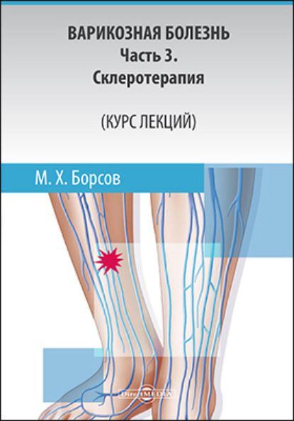 Варикозная болезнь: Часть 3 - Мухамед Хамзатович Борсов