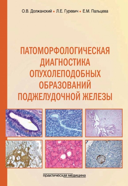 Патоморфологическая диагностика опухолеподобных образований поджелудочной железы. Руководство для врачей — Е. М. Пальцева