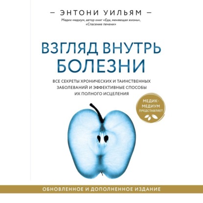 Взгляд внутрь болезни. Все секреты хронических и таинственных заболеваний и эффективные способы их полного исцеления — Энтони Уильям