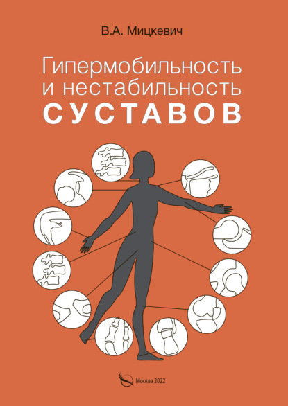 Гипермобильность и нестабильность суставов — В. А. Мицкевич