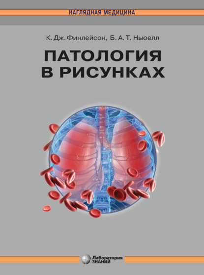 Патология в рисунках - Кэролайн Дж. Финлейсон