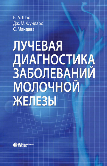 Лучевая диагностика заболеваний молочной железы - Джина М. Фундаро