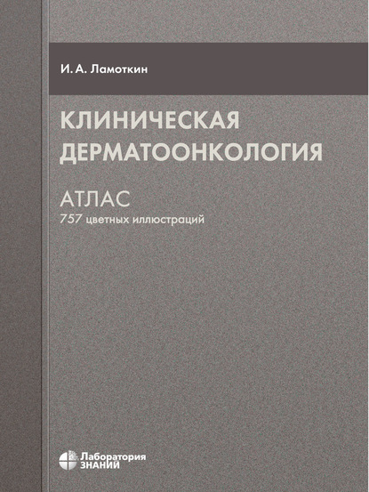 Клиническая дерматоонкология. Атлас - Игорь Ламоткин