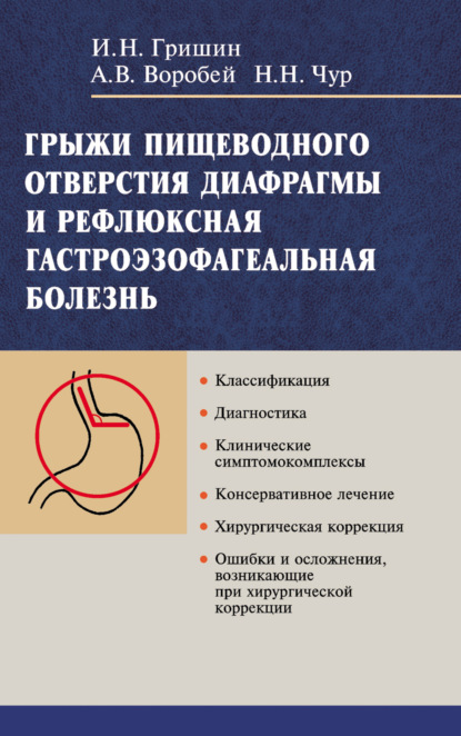 Грыжи пищеводного отверстия диафрагмы и рефлюксная гастроэзофагеальная болезнь - А. В. Воробей