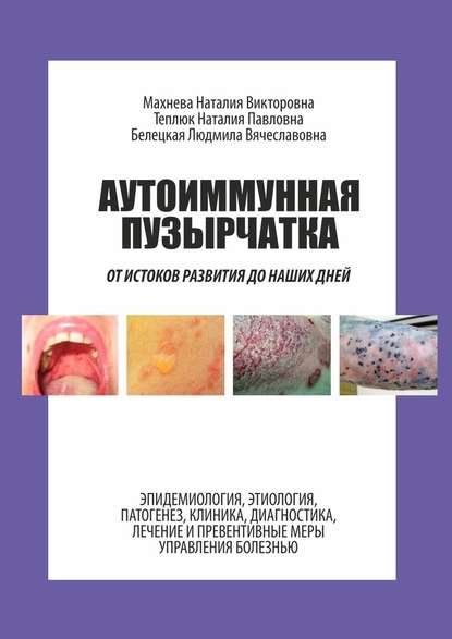 Аутоиммунная пузырчатка. От истоков развития до наших дней — Наталия Викторовна Махнева