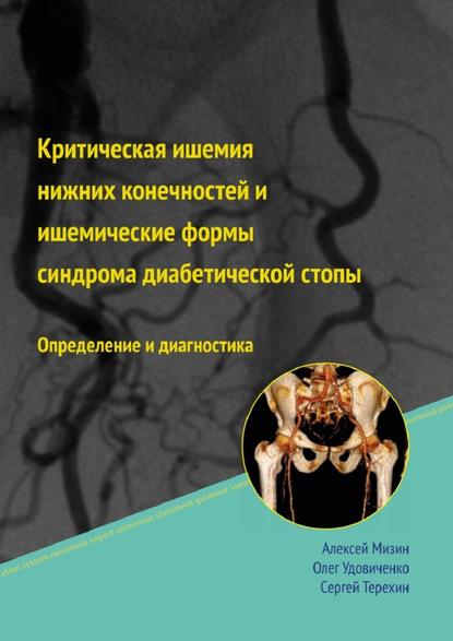 Критическая ишемия нижних конечностей и ишемические формы синдрома диабетической стопы - Алексей Мизин