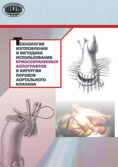 Технология изготовления и методика использования криосохраненных аллографтов в хирургии пороков аортального клапана — Ю. П. Островский