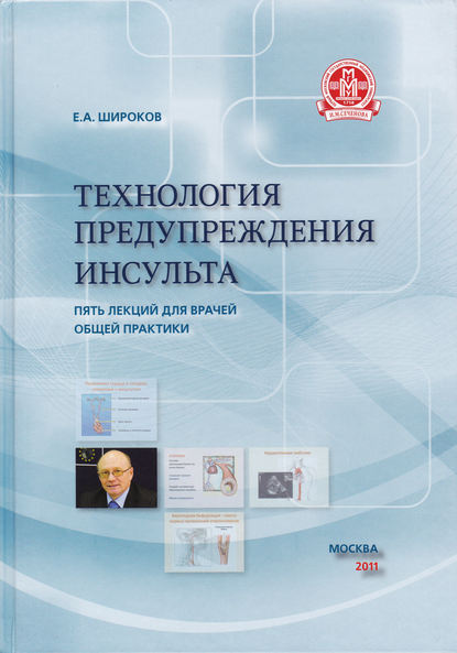 Технология предупреждения инсульта. Пять лекций для врачей общей практики - Евгений Широков