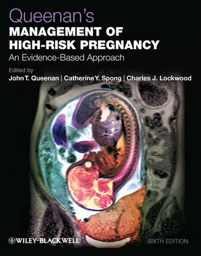 Queenan's Management of High-Risk Pregnancy - Группа авторов