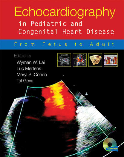 Echocardiography in Pediatric and Congenital Heart Disease — Группа авторов