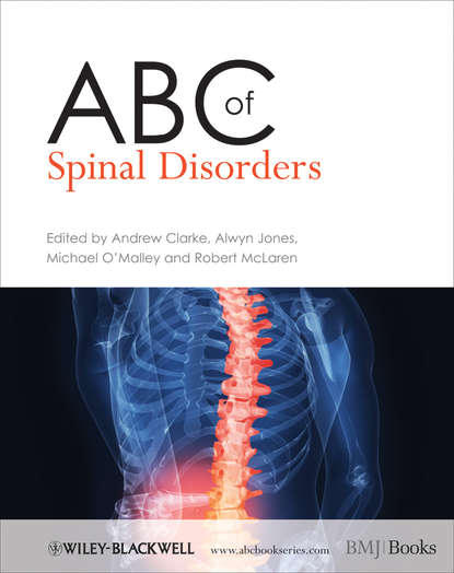 ABC of Spinal Disorders - Группа авторов