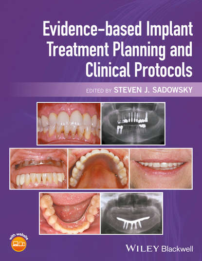 Evidence-based Implant Treatment Planning and Clinical Protocols — Группа авторов