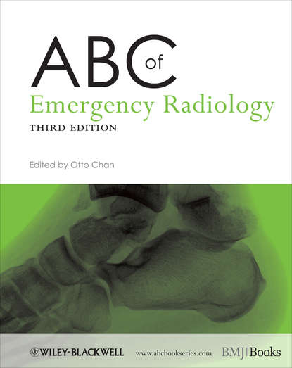 ABC of Emergency Radiology - Группа авторов