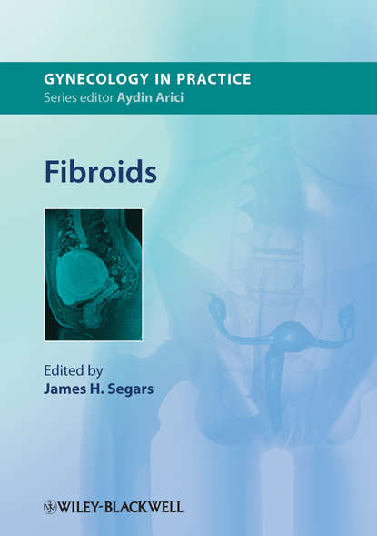 Fibroids - Группа авторов