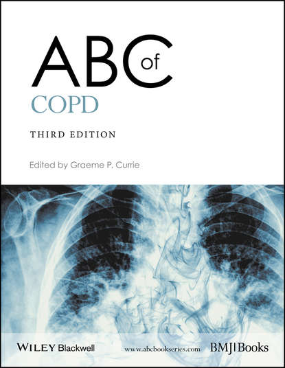 ABC of COPD - Группа авторов