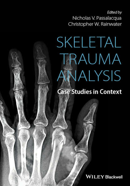 Skeletal Trauma Analysis — Группа авторов