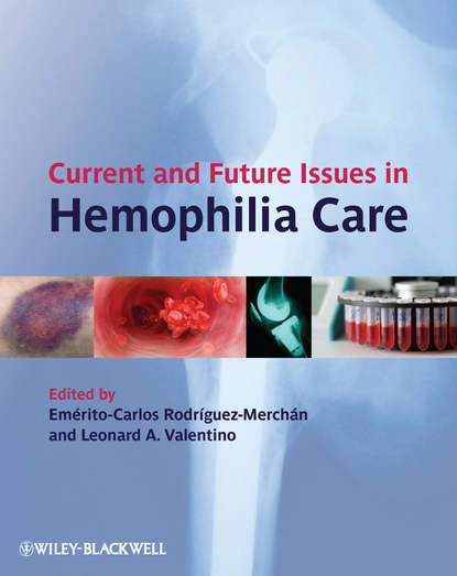 Current and Future Issues in Hemophilia Care — Группа авторов