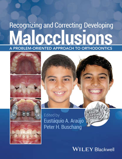 Recognizing and Correcting Developing Malocclusions - Группа авторов