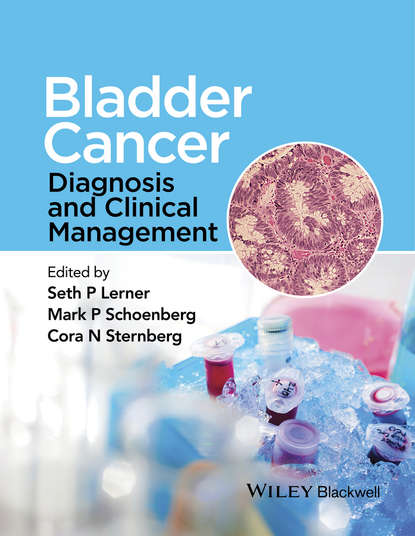 Bladder Cancer - Группа авторов