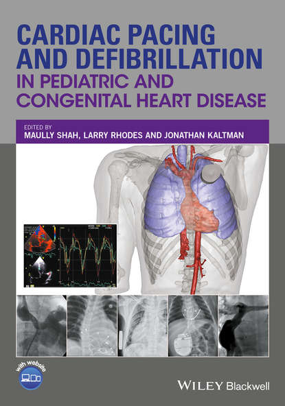 Cardiac Pacing and Defibrillation in Pediatric and Congenital Heart Disease - Группа авторов