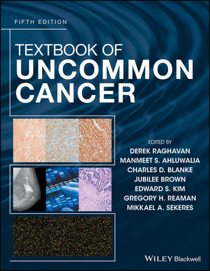 Textbook of Uncommon Cancer - Группа авторов