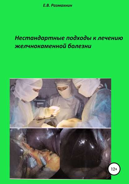 Нестандартные подходы к лечению желчнокаменной болезни - Евгений Владимирович Размахнин