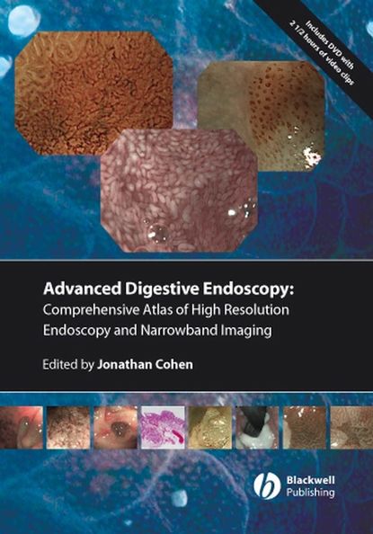 Comprehensive Atlas of High Resolution Endoscopy and Narrowband Imaging — Группа авторов