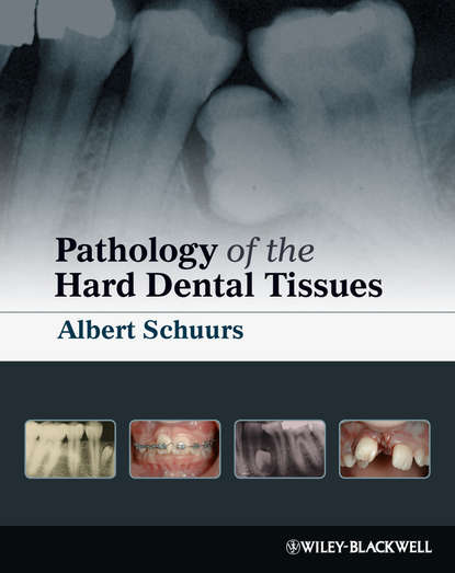 Pathology of the Hard Dental Tissues — Группа авторов