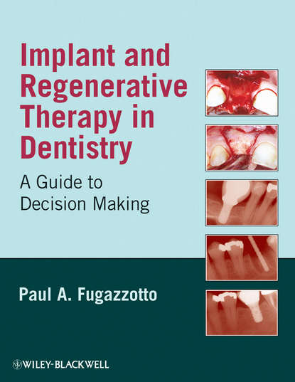 Implant and Regenerative Therapy in Dentistry — Группа авторов