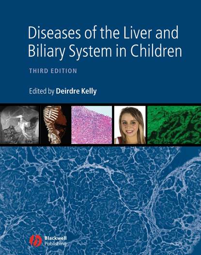 Diseases of the Liver and Biliary System in Children — Группа авторов