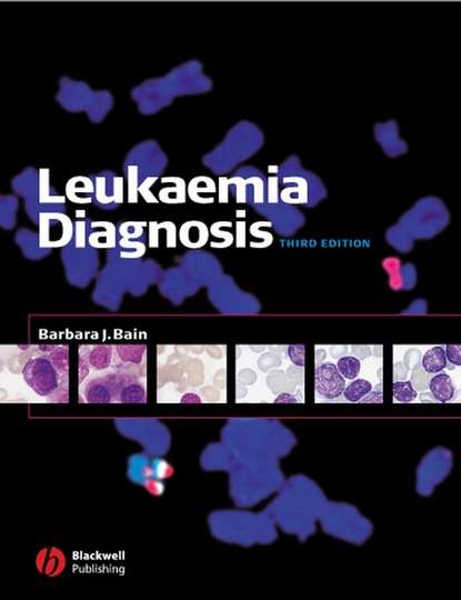 Leukaemia Diagnosis - Группа авторов