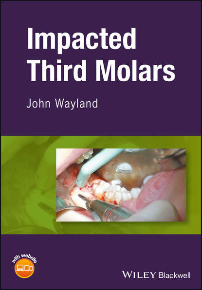 Impacted Third Molars - Группа авторов