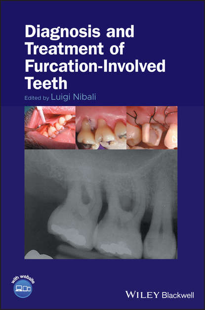 Diagnosis and Treatment of Furcation-Involved Teeth - Группа авторов