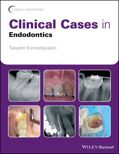 Clinical Cases in Endodontics — Группа авторов